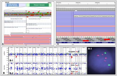 Clinical Impact of Genomic Information in Pediatric Leukemia